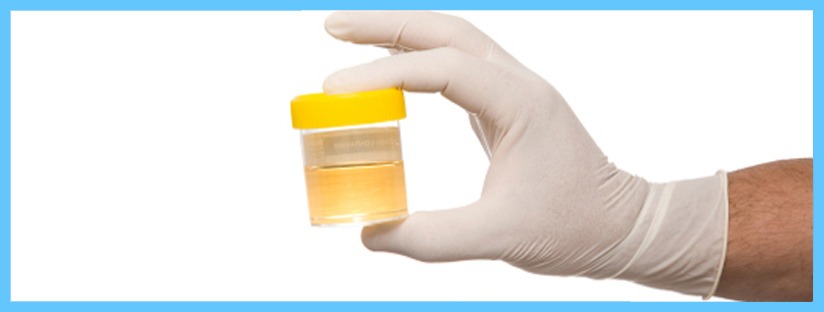 urinalysis-testing-std-testing-hiv-testing-same-day-std-testing