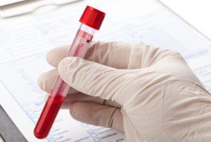 STD Blood Test Results Explained