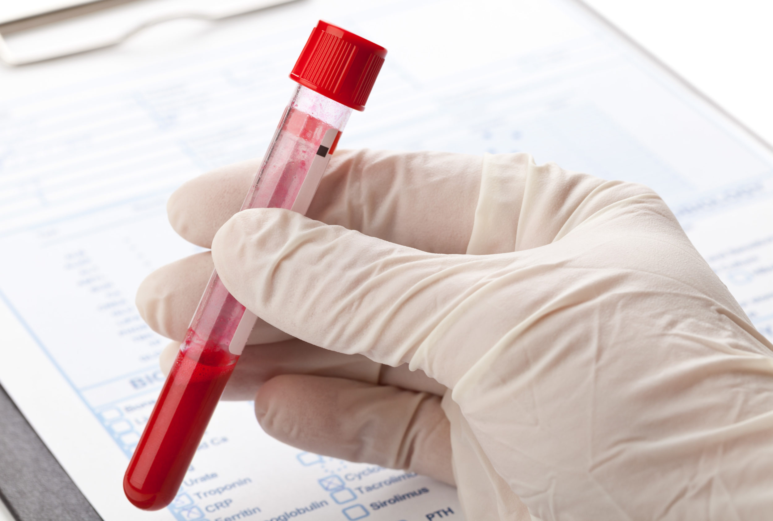 STD Blood Test Results Explained Same Day STD Testing In CLIA Certified Labs