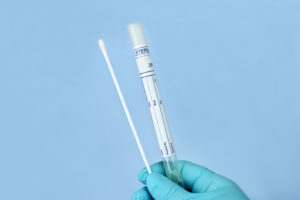 Is an STD Swab Test Painful?